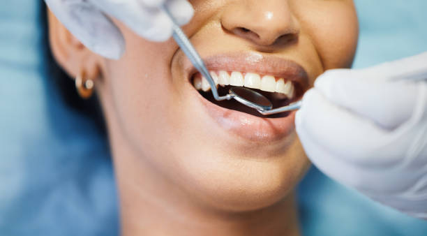 Best Broken Tooth Emergency  in Bronson, FL