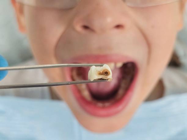 Best Tooth Infection Emergency Dentist  in Bronson, FL